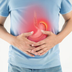 Gastric Tumor