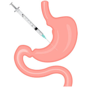 Gastric Botox