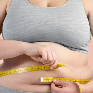 Gastric Bypass
