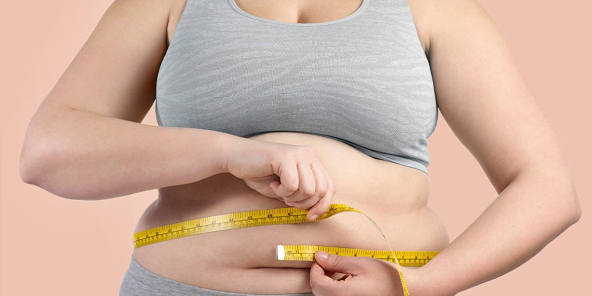 Gastric Bypass