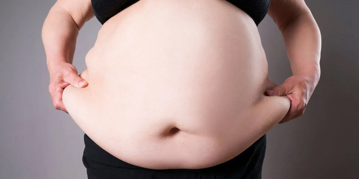 Gastric Sleeve Surgery