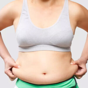 Stomach Reduction Surgery