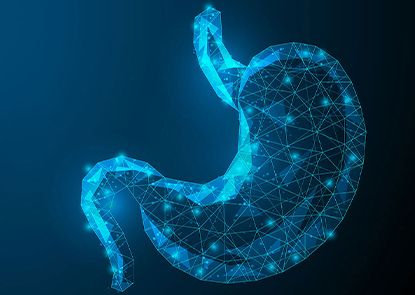 Gastric Sleeve Surgery