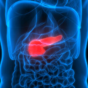 Pancreatic Cancer Treatment