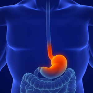 Stomach Cancer Treatment