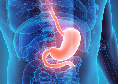 Gastrik Baypass